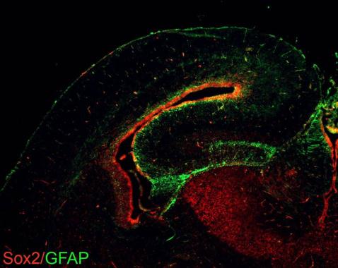 胎児マウス脳の免疫染色像