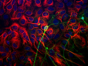 新生児マウス脳由来細胞の免疫染色像