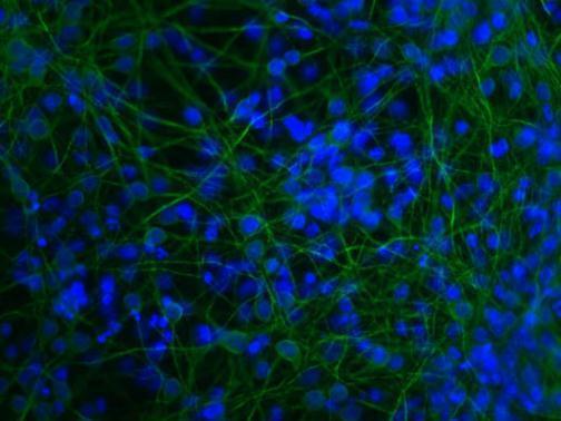 初代皮質神経培養細胞の免疫染色像