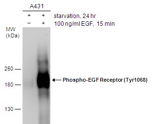 リン酸化抗EGFR抗体