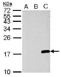 ヒストンコード（Histone Code）関連抗体 GeneTex社 抗ヒストン抗体