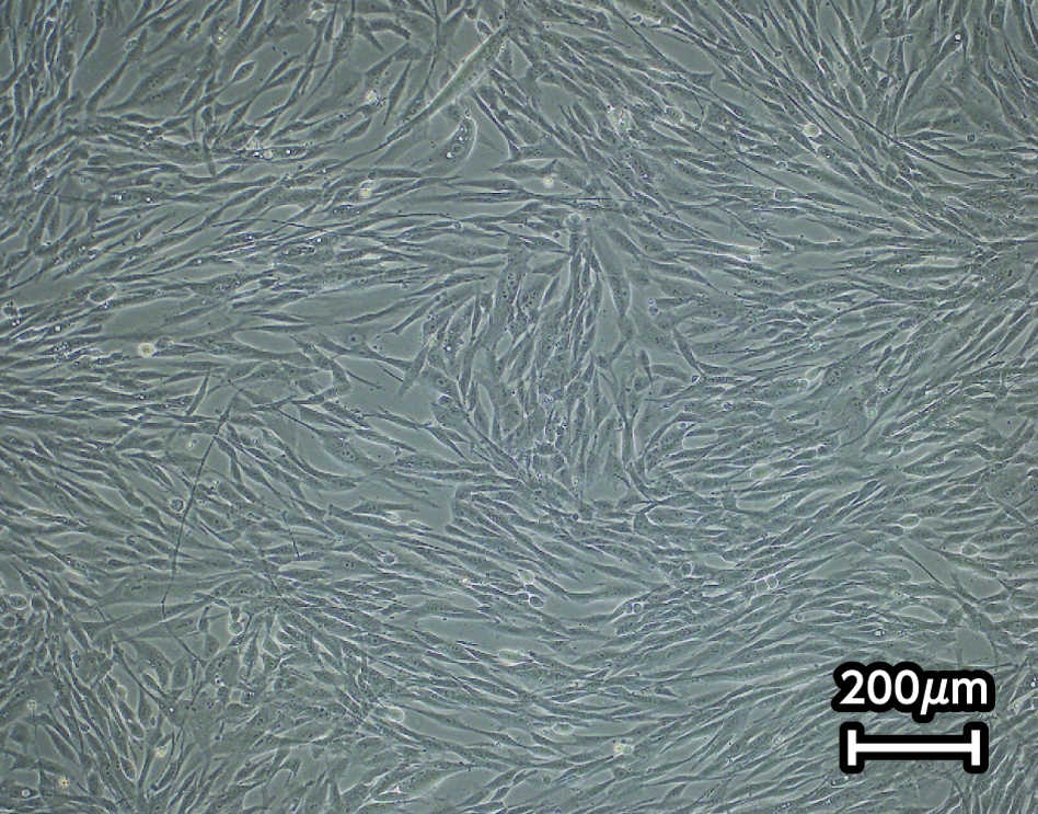 Xyltech Growth MSCで3日間培養したヒト脂肪由来間葉系幹細胞の形態