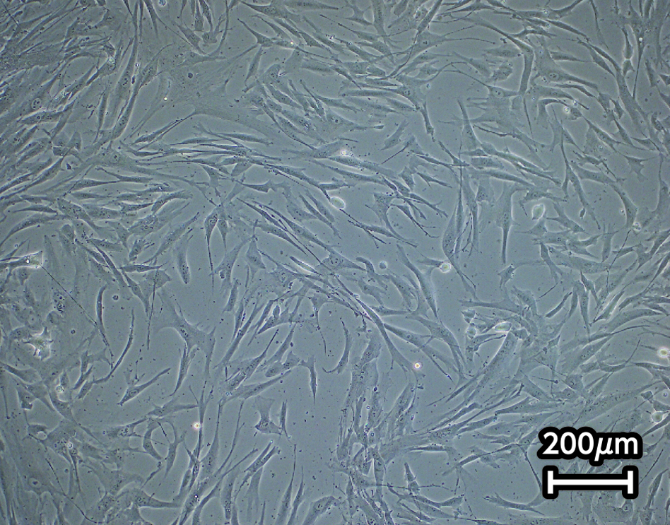 Xyltech MSC-01 Xeno-Freeで3日間培養したヒト脂肪由来間葉系幹細胞の形態