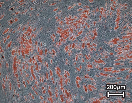 Xyltech  MSC-01 Xeno-Freeで3日間培養したヒト脂肪由来間葉系幹細胞の脂肪細胞への分化