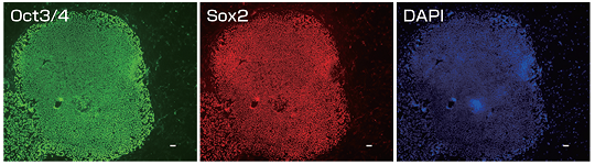 Fig.3 Expression of undifferentiation markers in human iPS cells (201B7 strain) after maintained in Xyltech BOF-01 for 3 days)