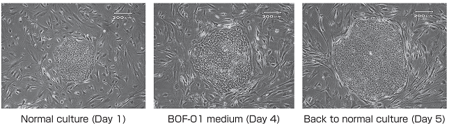 Fig.5 Colony morphology changes during culture by normal medium and Xyltech BOF-01.
