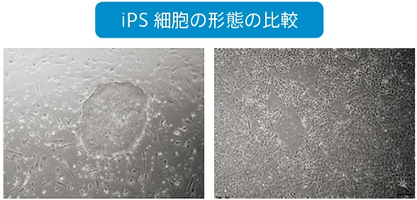 ナイーブ型iPS細胞