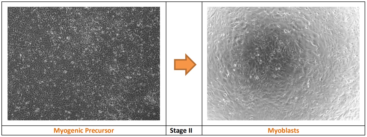 筋原性前駆細胞／衛星様細胞（Myogenic Precursor / Satellite-like Cell）から筋芽細胞（Myoblast）への移行