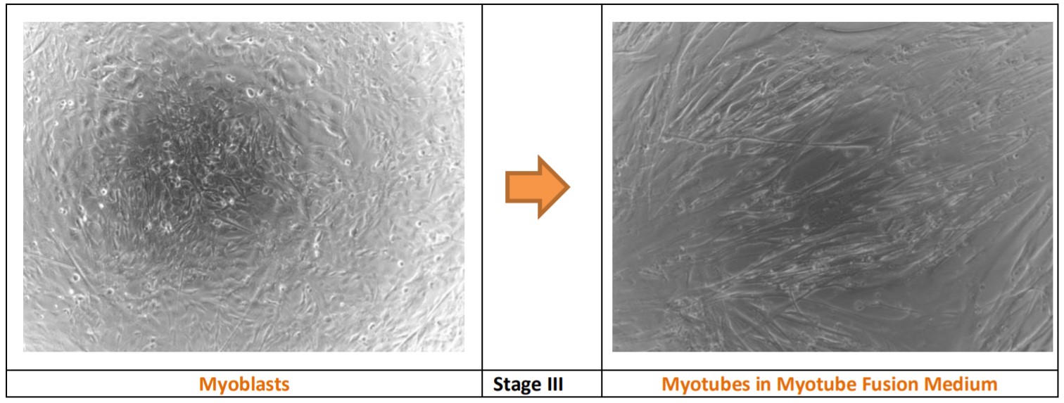筋芽細胞（Myoblast）から筋管（Myotube）への移行