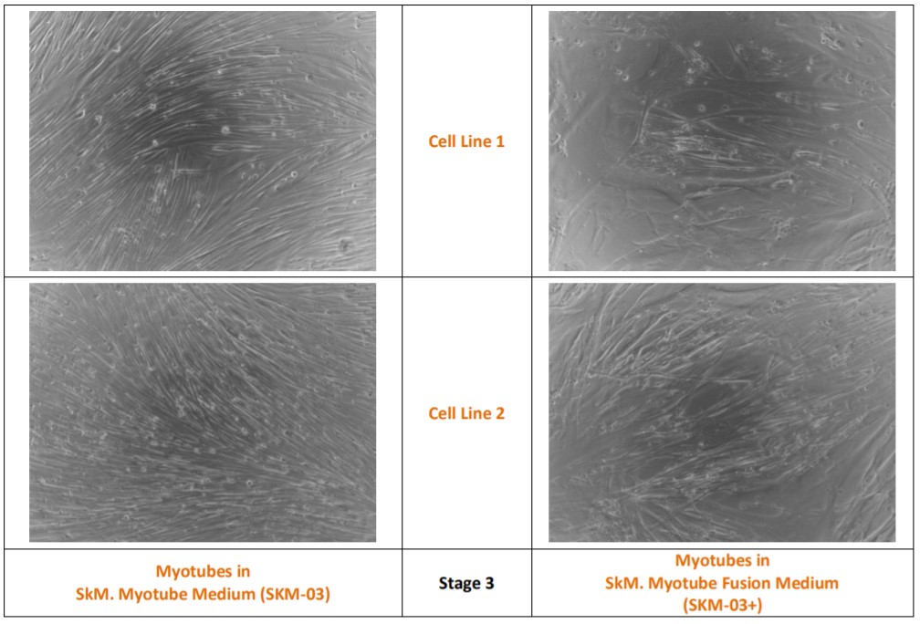 Stage ⅢにおけるMyotube mediumとMyotube fusion mediumの比較（1）