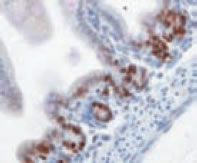 マウス腸ホルマリン固定パラフィン包埋切片を抗Ki67抗体（#NB110-89719）で免疫染色した。