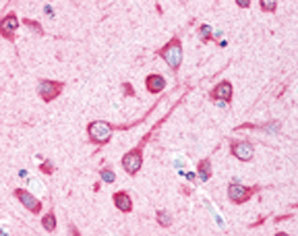 ヒト大脳皮質ニューロンの抗LC3抗体（#NB100-2220）による組織染色像