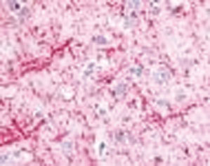 ヒト大脳皮質細胞突起の抗LC3抗体（#NB100-2331）による組織染色像
