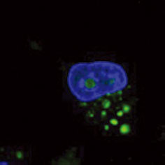 C2-ceramide処理U373-MG細胞の抗LC3B抗体（#NB600-1384）による蛍光染色像