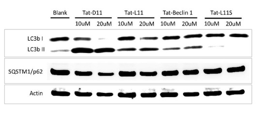 Tat-D11とTat-l1処理HeLa細胞におけるLC3bの誘導とp62の発現減少