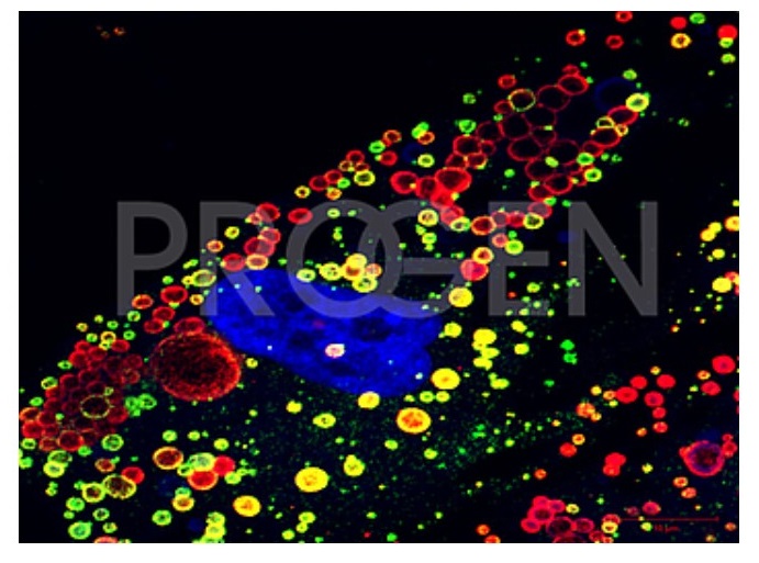 抗ペリリピン（Perilipin）抗体を用いたヒト脂肪細胞免疫染色像