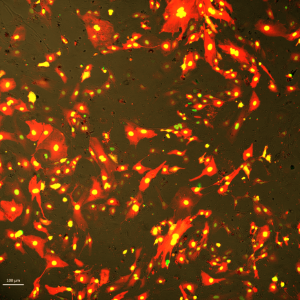 初代マウス肺内皮細胞にGFP / mCherry RNAを導入