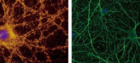 神経幹細胞の培養に最適な培地添加物 N-2 Media Supplement