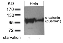 抗α-catenin(pSer641)抗体(#11330)の使用例
