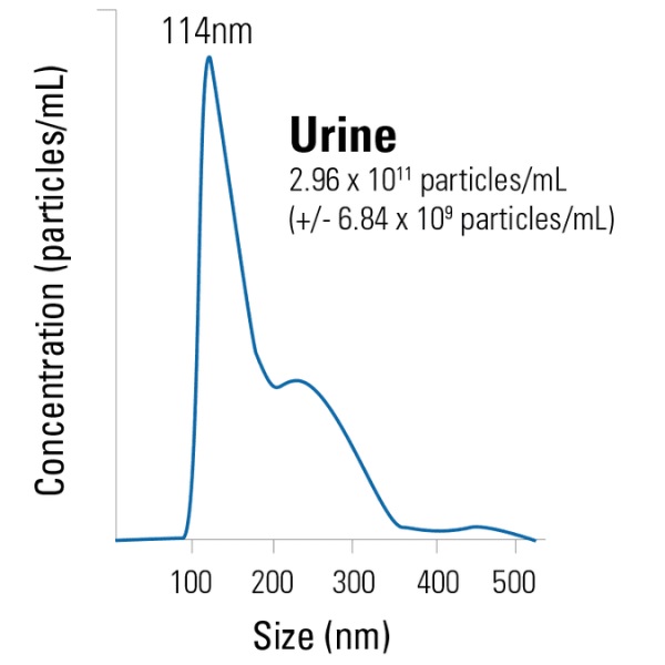 尿由来の精製エクソソームの粒子サイズ分布