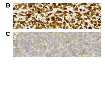 抗Histone 3.3 G34V抗体の使用例B