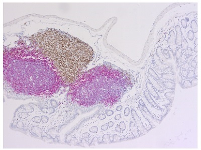 マウス結腸（ホルマリン固定パラフィン包埋）の二重免疫染色像