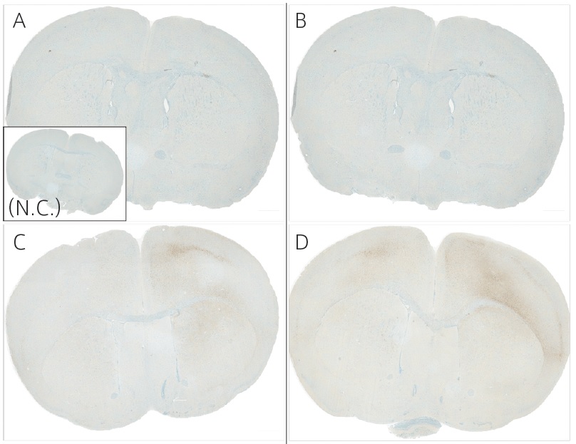 マウス脳背側線条体の片側にα-Synucleinモノマーまたはα-Synuclein PFFを注入した例