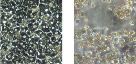 凍結肝細胞の顕微鏡画像