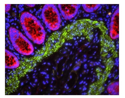 ヒト結腸の蛍光免疫多重染色像