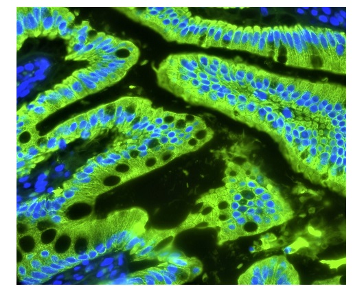 ヒト結腸の蛍光免疫染色像