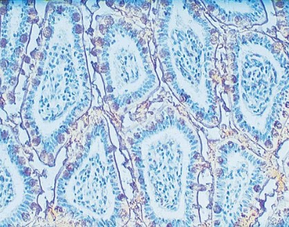 小腸の免疫組織化学染色像