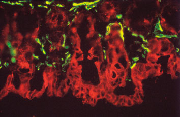 M.O.M. Fluorescein KitとM.O.M. Basic Kitを用いたマウス小腸組織切片の免疫染色