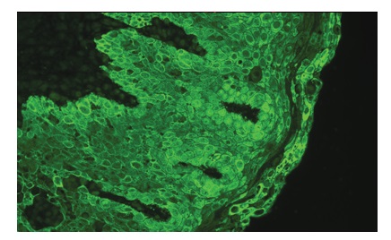 扁桃腺CD34 をR.T.U. VectaFluor DyLight 488 Anti-Rabbit IgG(#DI-1788)で免疫蛍光染色