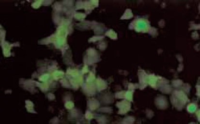 アデノウイルスAd5とGFPの複合体を感染させたCOS-1細胞の画像