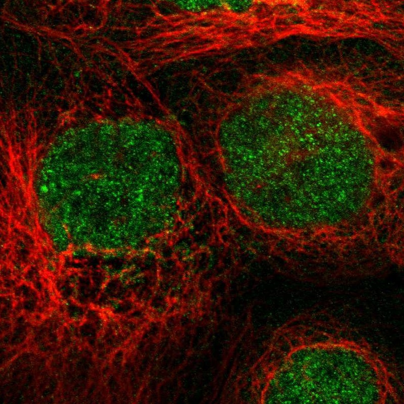 Immunofluorescent staining of human cell line A-431 shows localization to nucleus. Antibody staining is shown in green.
