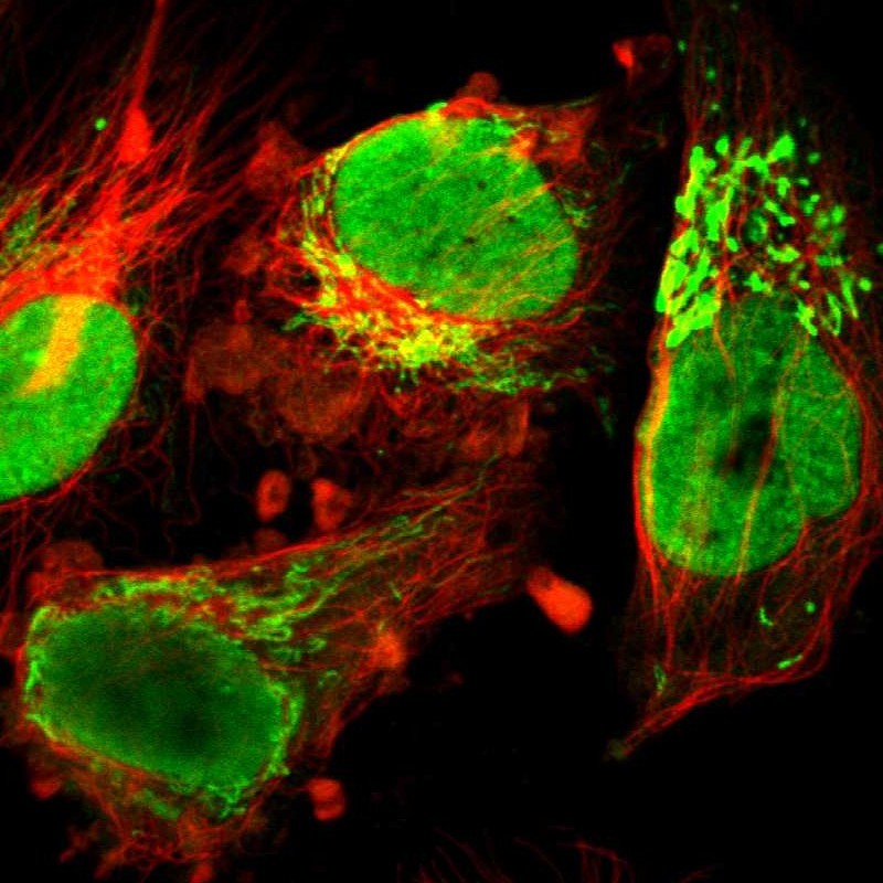 Immunofluorescent staining of human cell line U-251 MG shows localization to nucleoplasm, nucleoli & mitochondria. Antibody staining is shown in green.