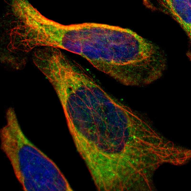 Immunofluorescent staining of human cell line U-2 OS shows localization to endoplasmic reticulum. Antibody staining is shown in green.