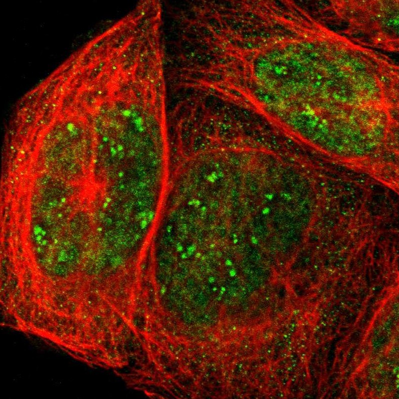 Immunofluorescent staining of human cell line A-431 shows localization to nucleus, nucleoli fibrillar center & cytosol. Antibody staining is shown in green.
