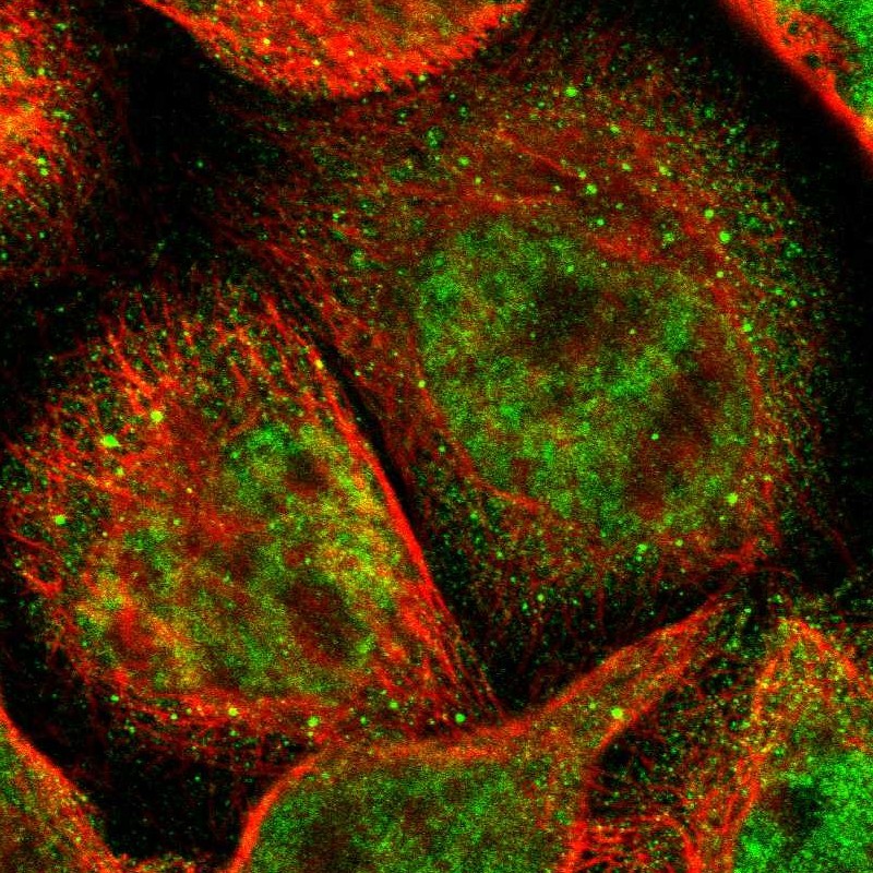 Immunofluorescent staining of human cell line A-431 shows localization to nucleoplasm, cytosol & vesicles. Antibody staining is shown in green.