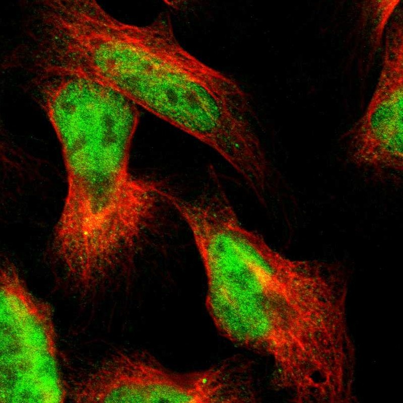 Immunofluorescent staining of human cell line U-2 OS shows localization to nucleoplasm. Antibody staining is shown in green.