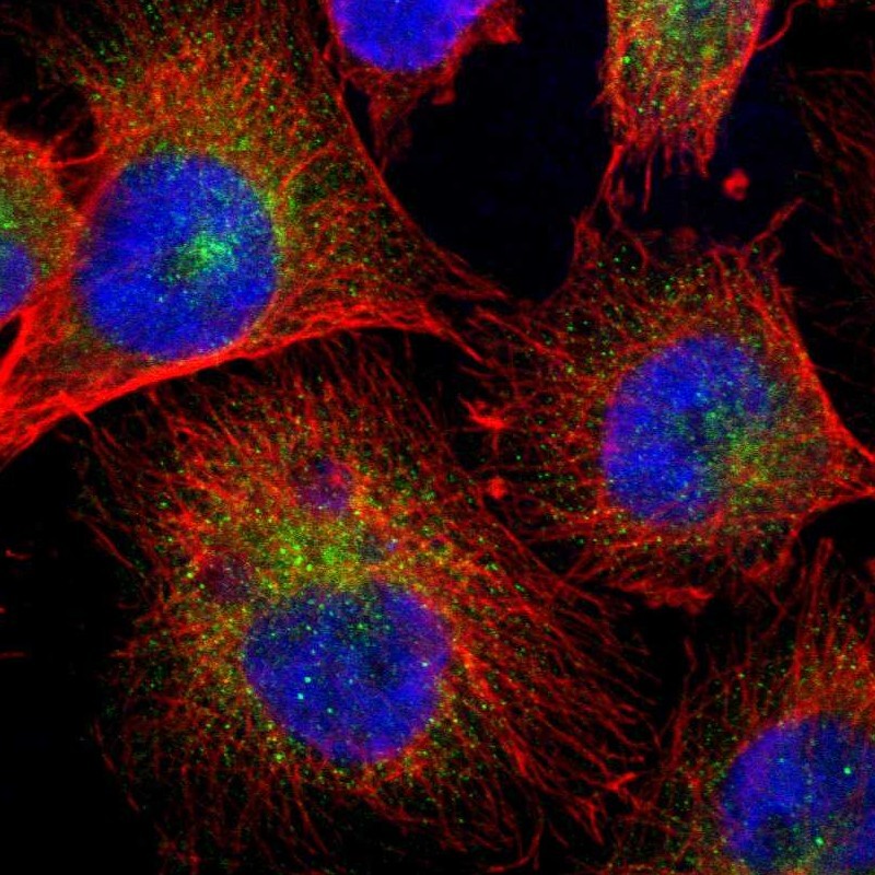 Immunofluorescent staining of human cell line U-251 MG shows localization to vesicles. Antibody staining is shown in green.