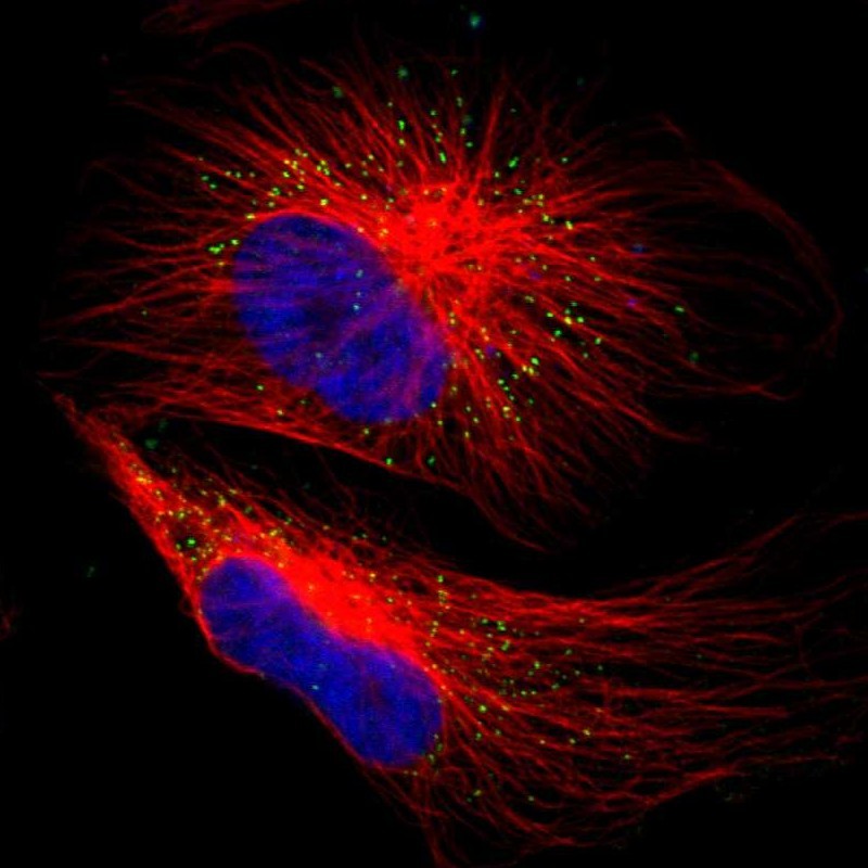 Immunofluorescent staining of human cell line U-251 MG shows localization to peroxisomes. Antibody staining is shown in green.