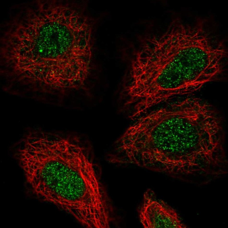 Immunofluorescent staining of human cell line A549 shows localization to nucleus. Antibody staining is shown in green.