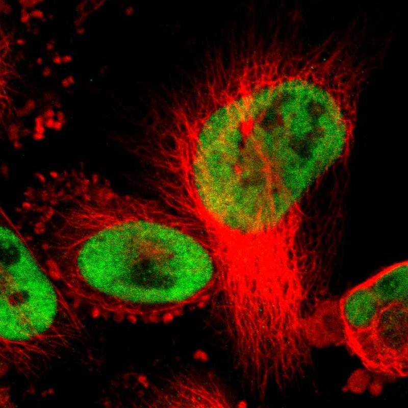 Immunofluorescent staining of human cell line U-251 MG shows localization to nucleoplasm. Antibody staining is shown in green.