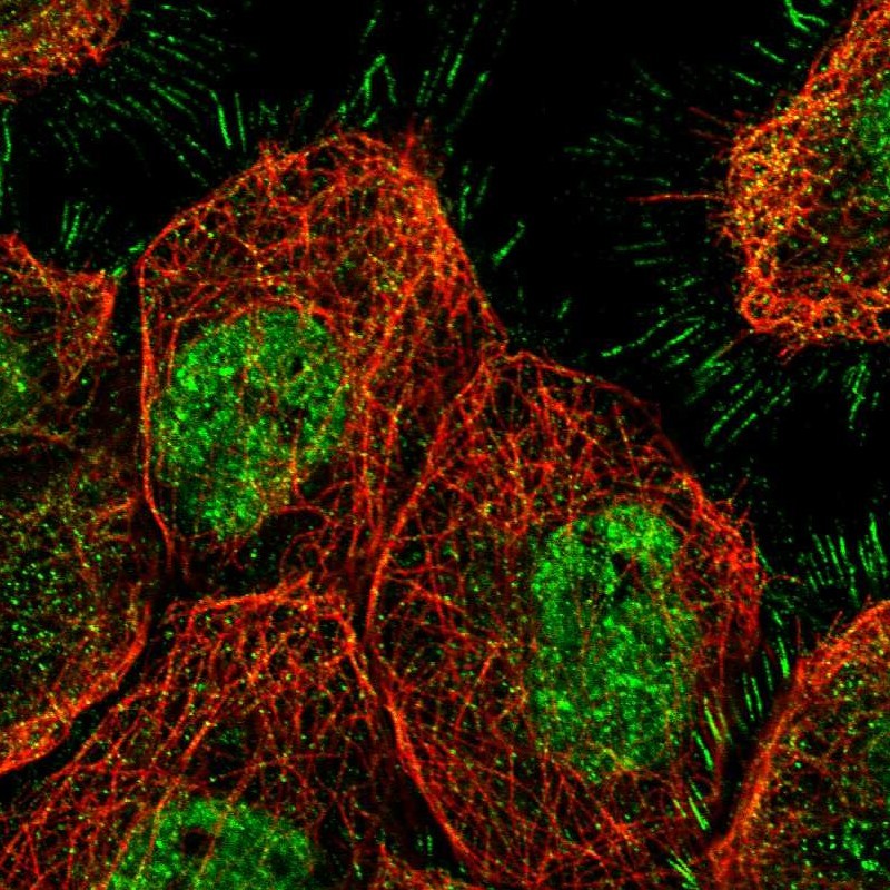 Immunofluorescent staining of human cell line A-431 shows localization to nucleoplasm, plasma membrane & cytosol. Antibody staining is shown in green.