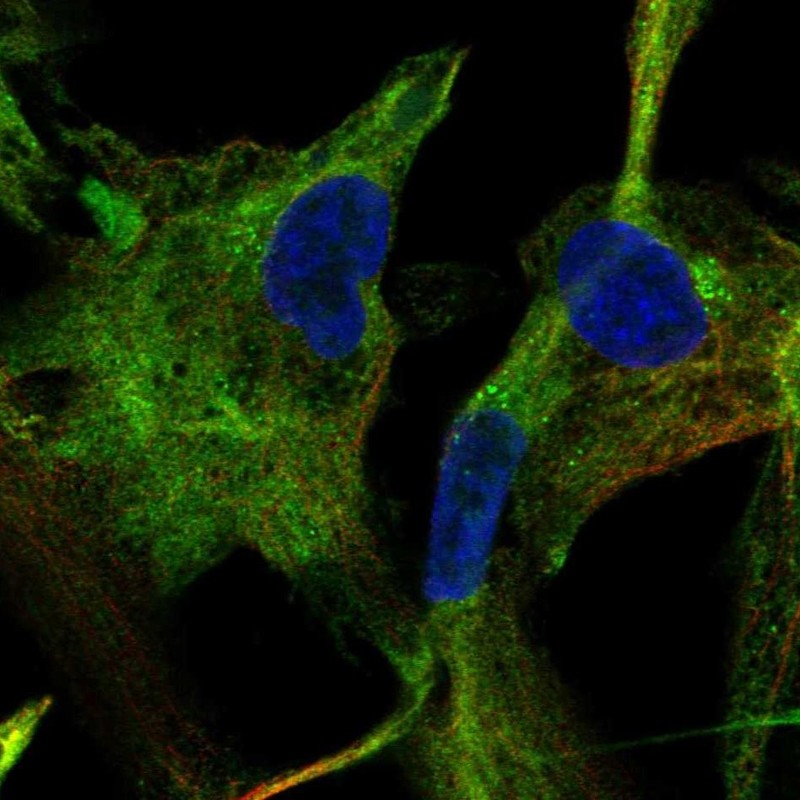 Immunofluorescent staining of human cell line LHCN-M2 shows localization to cytosol. Antibody staining is shown in green.