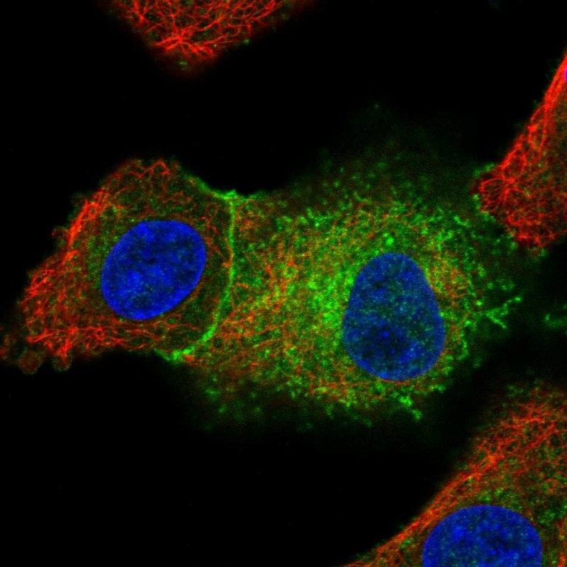 Immunofluorescent staining of human cell line A549 shows localization to plasma membrane & cytosol. Antibody staining is shown in green.