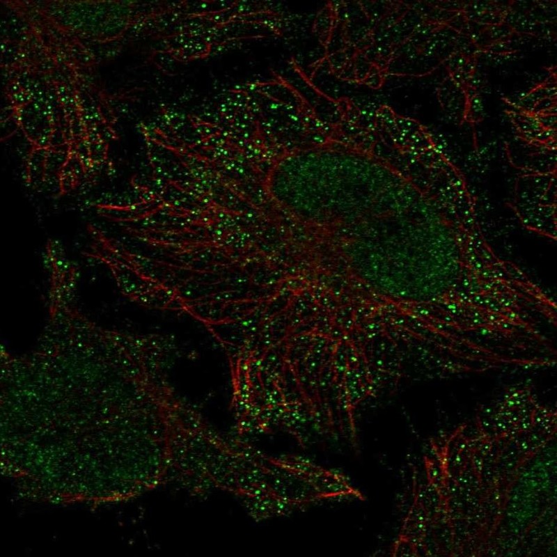 Immunofluorescent staining of human cell line HeLa shows localization to nucleoplasm & vesicles. Antibody staining is shown in green.