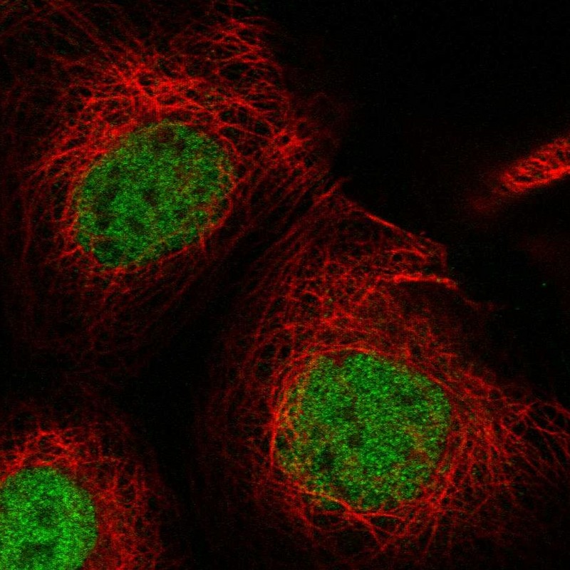 Immunofluorescent staining of human cell line A-431 shows localization to nucleoplasm. Antibody staining is shown in green.