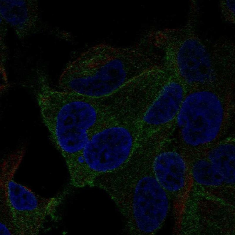 Immunofluorescent staining of human cell line SK-MEL-30 shows localization to plasma membrane. Antibody staining is shown in green.